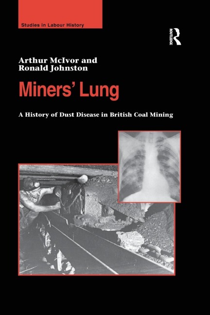 Miners Lung: A History of Dust Disease in British Coal Mining