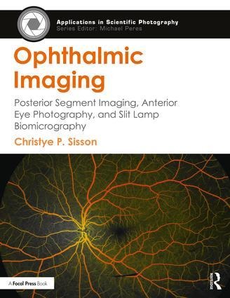 Ophthalmic Imaging: Posterior Segment Imaging, Anterior Eye Photography, and Slit Lamp Biomicrography