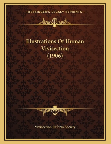 Illustrations Of Human Vivisection (1906)