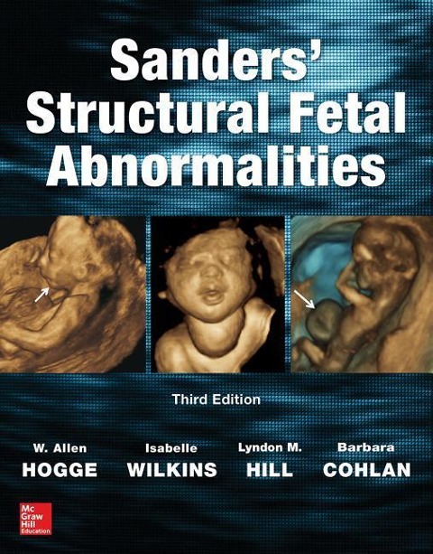 Sanders Structural Fetal Abnormalities, Third Edition