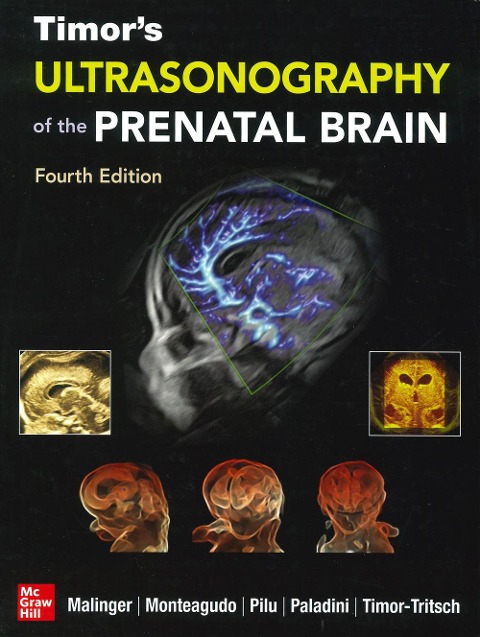Timor's Ultrasonography of the Prenatal Brain, Fourth Edition