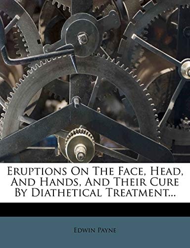 Eruptions On The Face, Head, And Hands, And Their Cure By Diathetical Treatment...