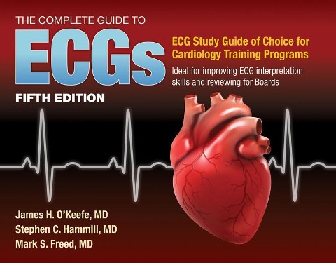 The Complete Guide to Ecgs: A Comprehensive Study Guide to Improve ECG Interpretation Skills: A Comprehensive Study Guide to Improve ECG Interpretation Skills