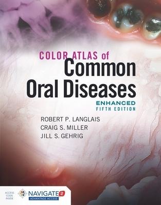 Color Atlas of Common Oral Diseases, Enhanced Edition