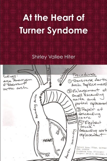 At the Heart of Turner Syndrome