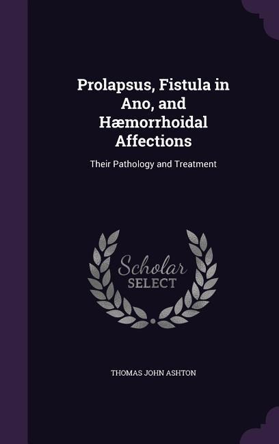Prolapsus, Fistula in Ano, and Hæmorrhoidal Affections: Their Pathology and Treatment