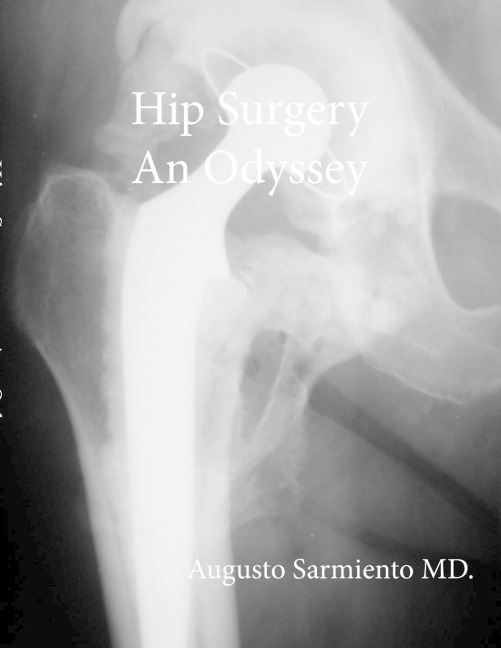 Hip Surgery - An Odyssey