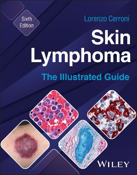 Skin Lymphoma: The Illustrated Guide