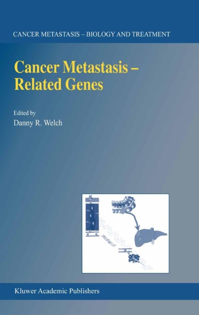 Cancer Metastasis -- Related Genes