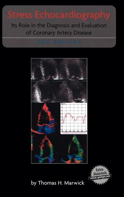 Stress Echocardiography: Its Role in the Diagnosis and Evaluation of Coronary Artery Disease