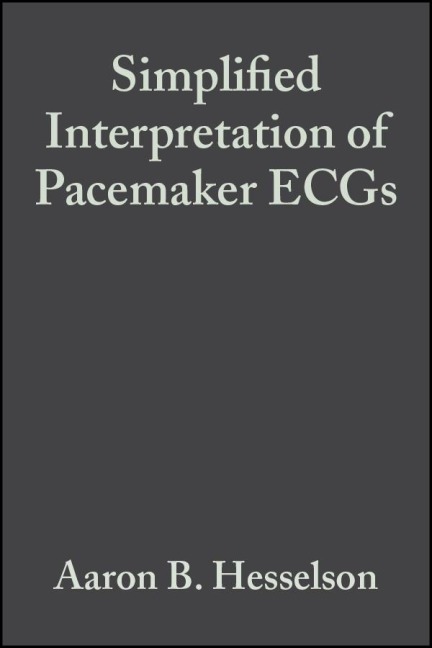 Simplified Interpretation of Pacemaker Ecgs