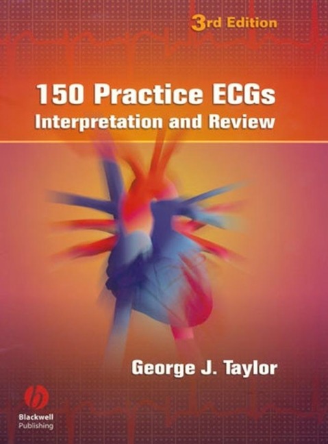 150 Practice Ecgs: Interpretation and Review