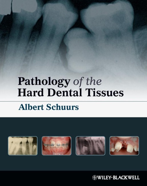 Pathology of the Hard Dental T