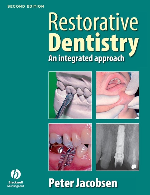 Restorative Dentistry 2e