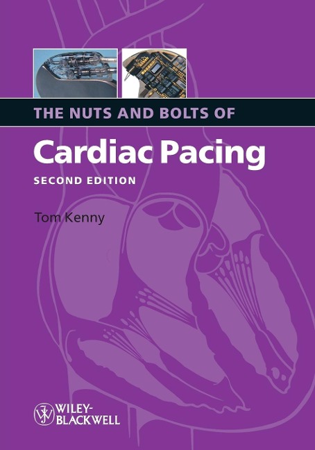 Nuts Bolts Cardiac Pacing 2e