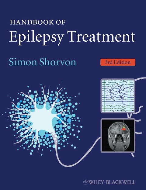 Handbook Epilepsy Treatment 3e
