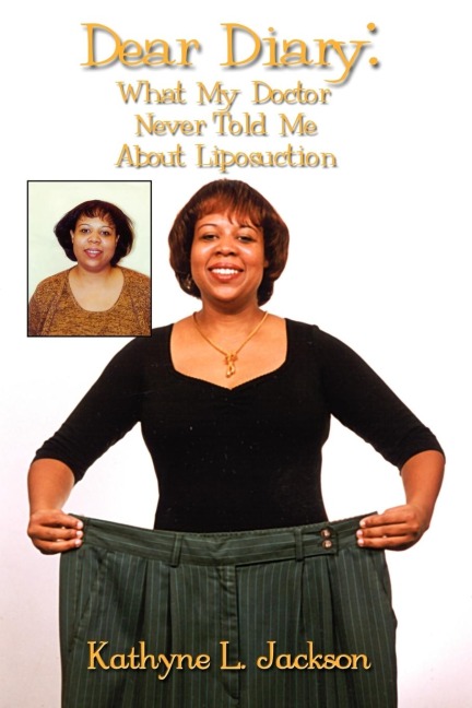 Dear Diary: What My Doctor Never Told Me About Liposuction