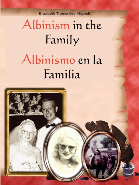 Albinism in the Family: Albinismo en la Familia