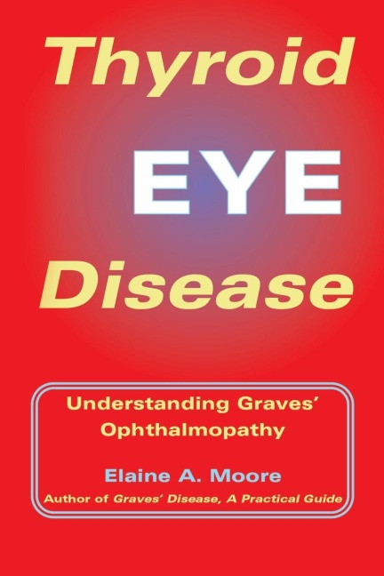 Thyroid Eye Disease: Understanding Graves Ophthalmopathy