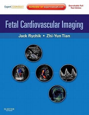Fetal Cardiovascular Imaging