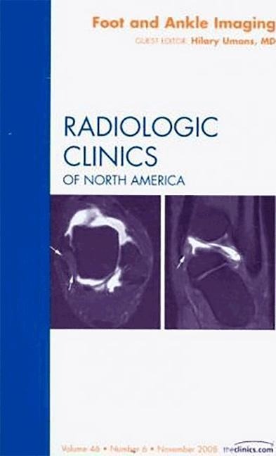 Foot and Ankle Imaging, an Issue of Radiologic Clinics: Volume 46-6