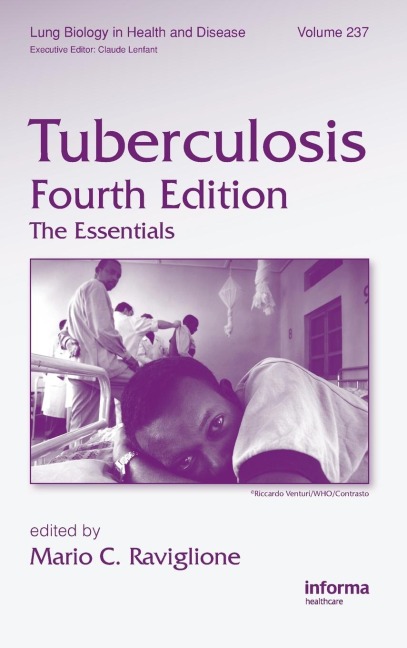 Tuberculosis: The Essentials, Fourth Edition