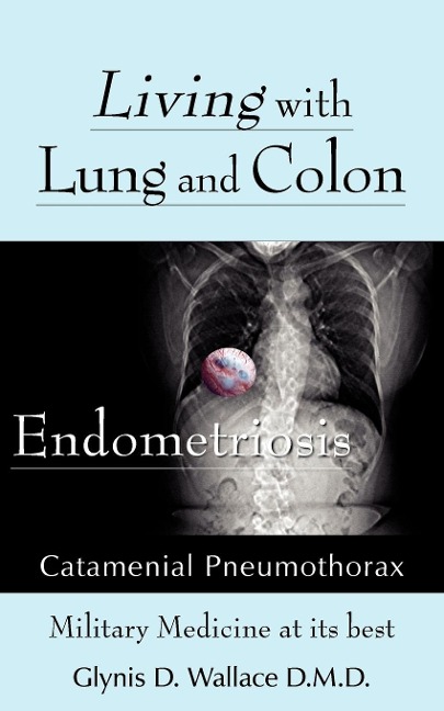 Living With Lung and Colon Endometriosis: Catamenial Pneumothorax