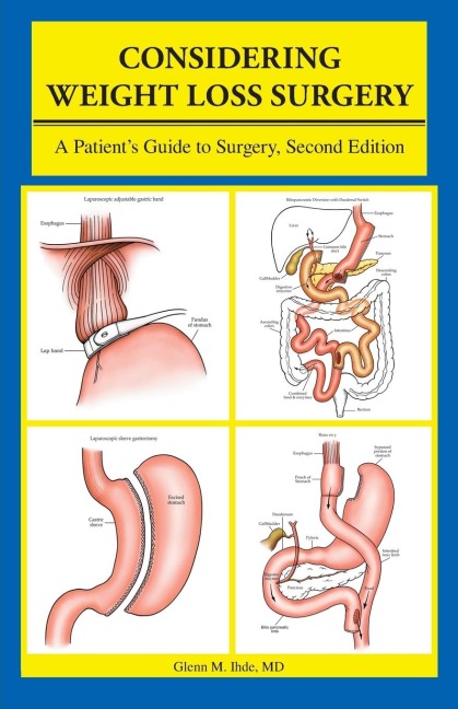 Considering Weight Loss Surgery: A Patients Guide to Surgery, Second Edition