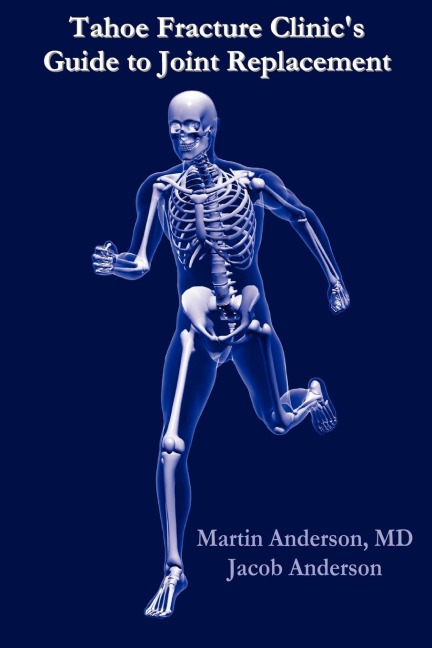 Tahoe Fracture Clinics Guide to Joint Replacement