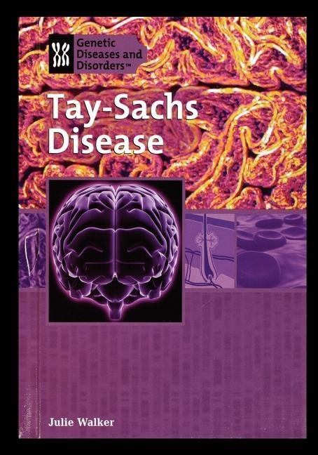 Tay-Sachs Disease