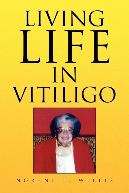 Living Life in Vitiligo