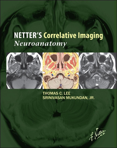 Netter's Correlative Imaging: Neuroanatomy