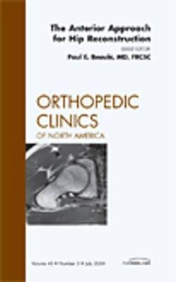 The Anterior Approach for Hip Reconstruction, an Issue of Orthopedic Clinics: Volume 40-3