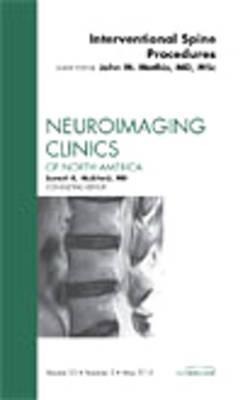 Image-Guided Spine Interventions, an Issue of Neuroimaging Clinics: Volume 20-2