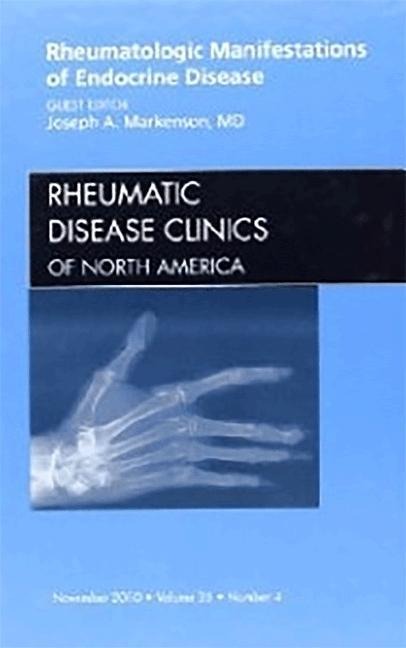 Rheumatologic Manifestations of Endocrine Disease, an Issue of Rheumatic Disease Clinics: Volume 36-4