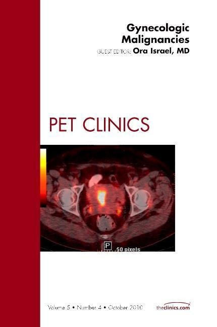 Gynecologic Malignancies, an Issue of Pet Clinics: Volume 5-4