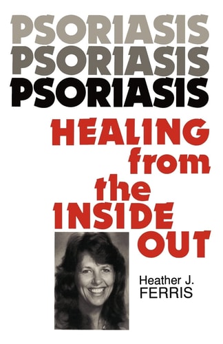 Psoriasis Healing from the Inside Out