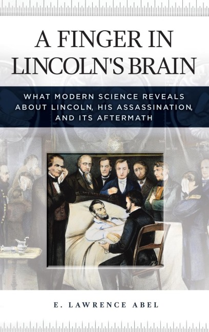A Finger in Lincolns Brain: What Modern Science Reveals about Lincoln, His Assassination, and Its Aftermath