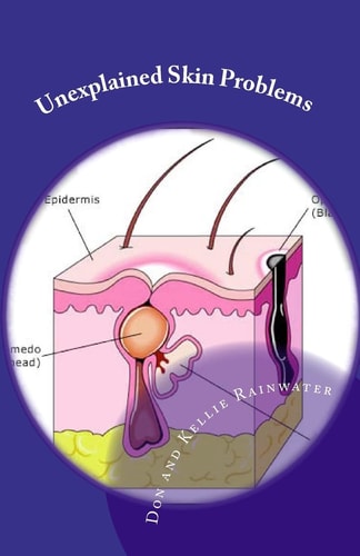 Unexplained Skin Problems Home Treatment and Precautions