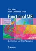 Functional MRI: Basic Principles and Clinical Applications