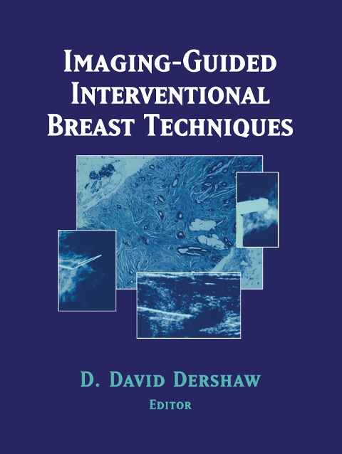 Imaging-Guided Interventional Breast Techniques