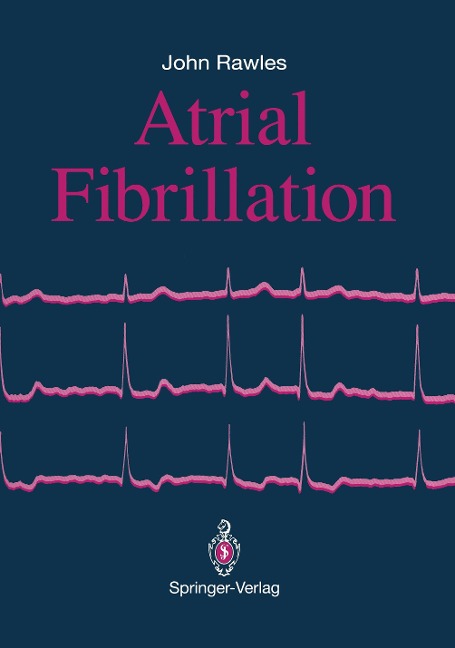 Atrial Fibrillation
