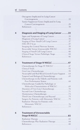 Dx/Rx: Lung Cancer