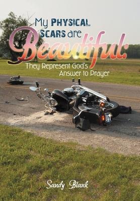 My Physical Scars Are Beautiful: They Represent Gods Answer to Prayer