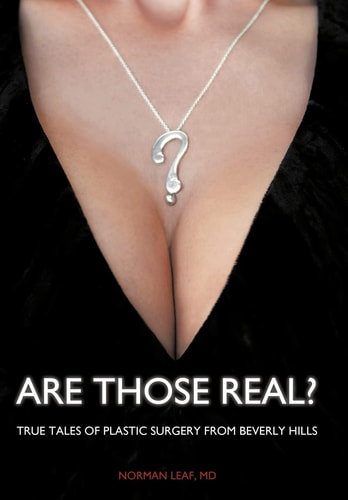 Are Those Real? True Tales of Plastic Surgery from Beverly Hills