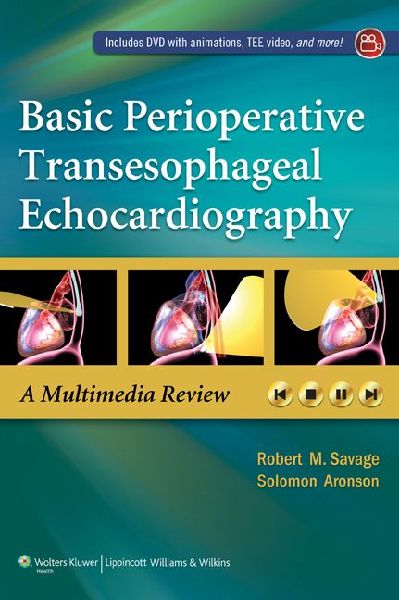 Basic Perioperative Transesophageal Echocardiography