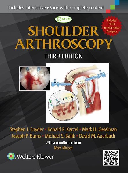 Shoulder Arthroscopy