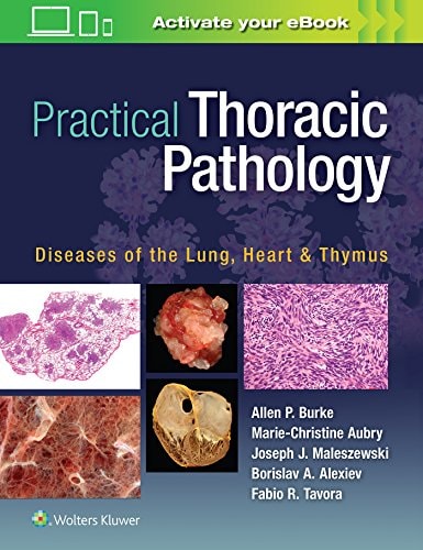Practical Thoracic Pathology Diseases of the Lung, Heart, and Thymus