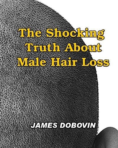 The Shocking Truth About Male Hair Loss Secrets You Need to Know About Losing Hair So You Can Stop From Going Bald