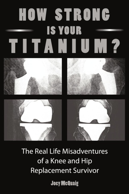 How Strong Is Your Titanium: The Real Life Misadventures of a Knee and Hip Replacement Survivor